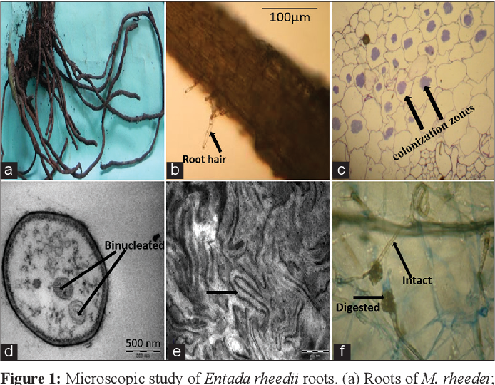 Vels Institute of Science, Technology & Advanced Studies最新研究：大风湿病菌形态及兰花 ...